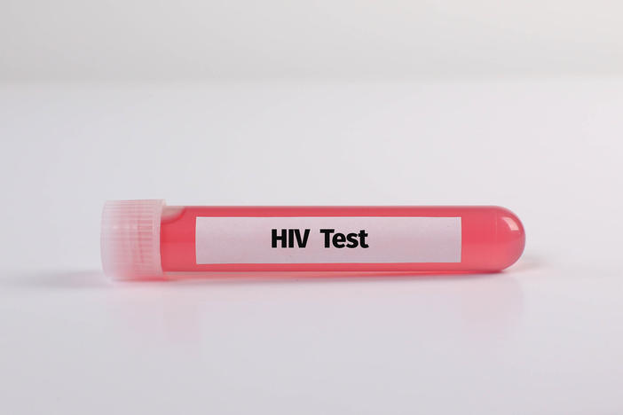 HIV test