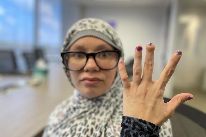 Nova Jaswan hold up her hand showing where her middle finger was damaged by a jail cell door