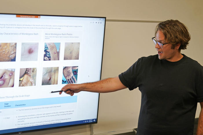 a man points to images of monkeypox rashes