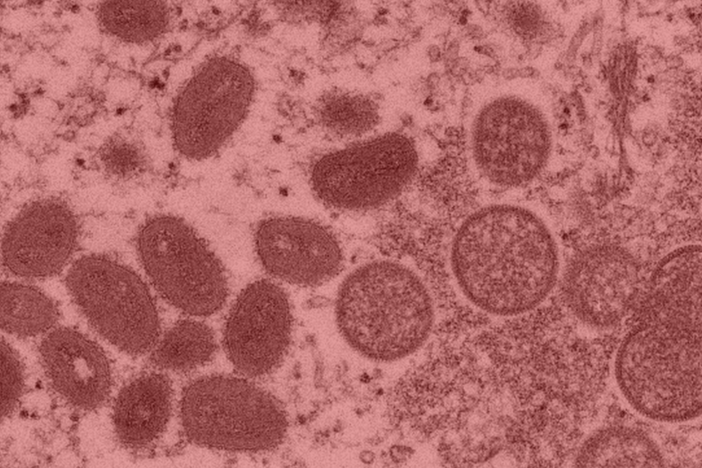A microscopic image of monkeypox virus 