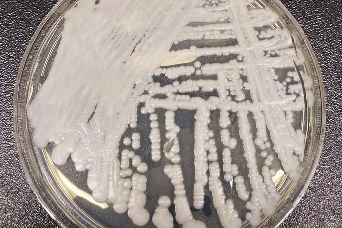 A strain of Candida auris cultured in a petri dish.