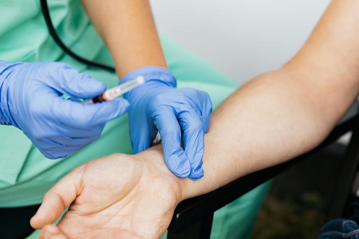 Nurse checking pulse. (Pexels)