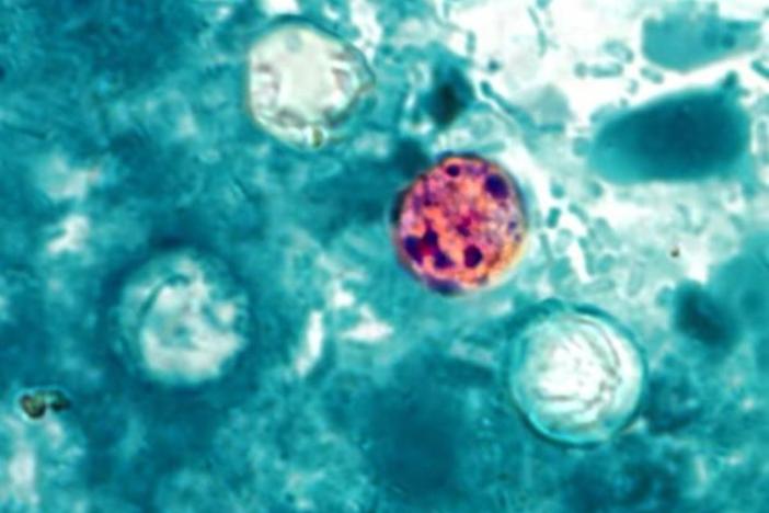Courtesy, <a href="http://commons.wikimedia.org/wiki/File:Cyclospora_cayetanensis.jpg" target="_blank">Wikimedia</a>