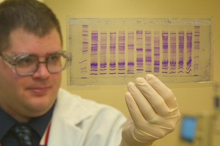 Courtesy, <a href="http://en.wikipedia.org/wiki/DNA_profiling" target="_blank">Wikipedia</a>