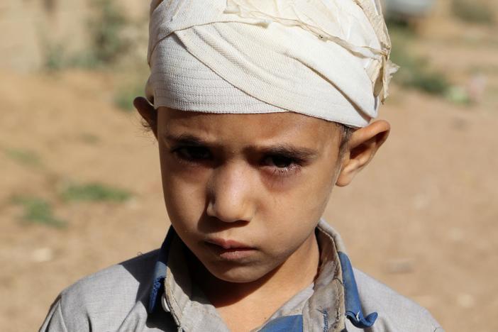 Will pressure on the Saudi crown prince impact the humanitarian crisis in Yemen?