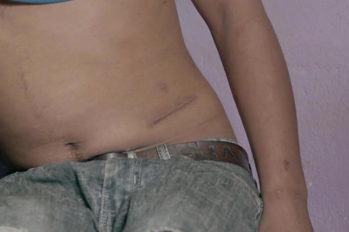 Human trafficking victims forced to sell their organs share harrowing stories