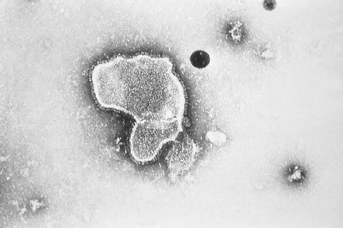 Hospitals caring for high numbers of children infected with respiratory illnesses