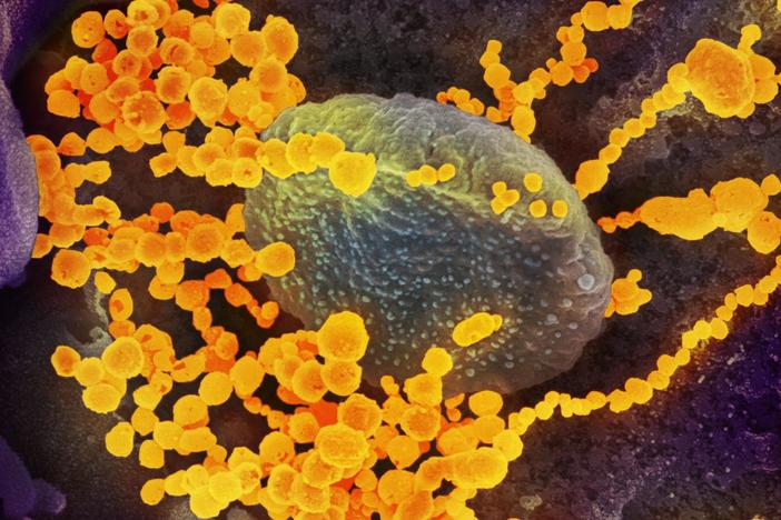 What is covid-19 and should you be worried?