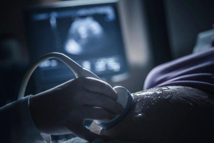 Why abortion opponents support Trump's Title X rule change