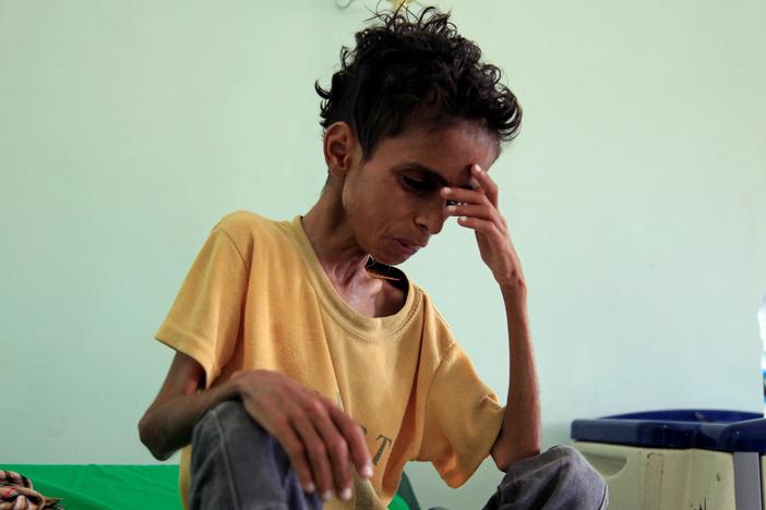 What conflict-torn Yemen needs to keep more children from dying