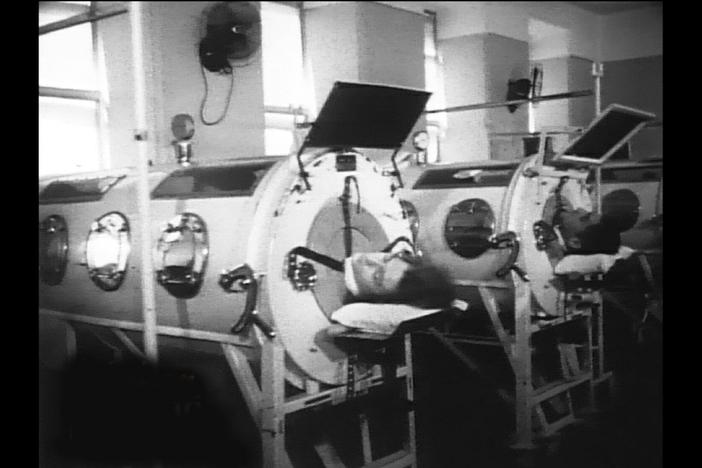 An iron lung allowed Tanaquil Le Clercq to breathe after she contracted polio in 1956. 
