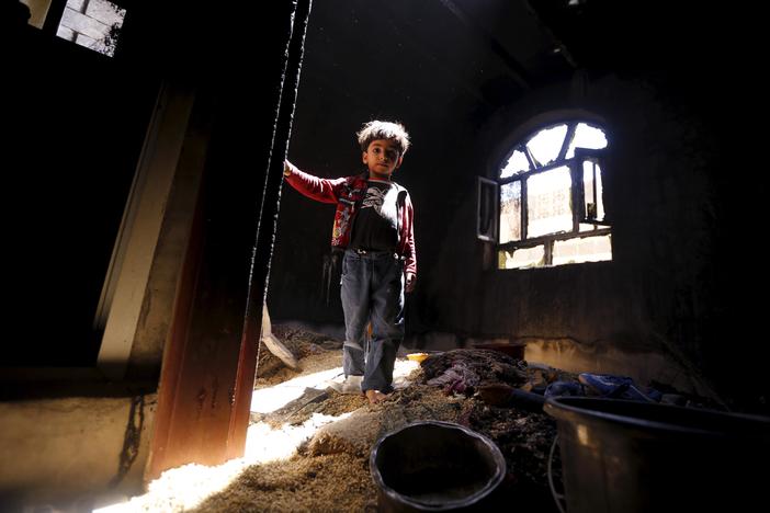 In Yemen the most vulnerable victims are the 2 million children on the brink of starvation