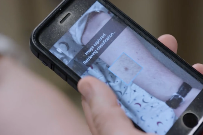 A deep learning system has learned to accurately identify skin cancers in photographs.