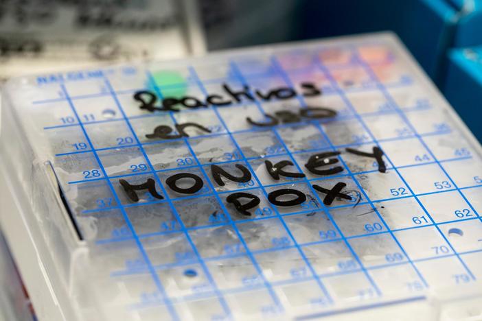 White House pledges more vaccines for monkeypox infections