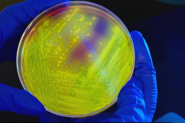 Why overuse of antibiotics is a massive, 'staggering' problem in health care
