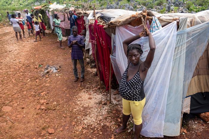 10 days after devastating Haiti earthquake, many survivors finally get medical attention