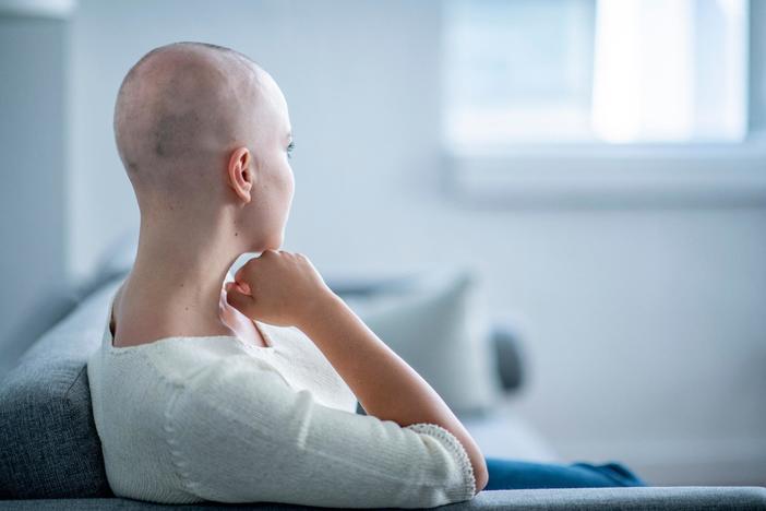People with alopecia share their stories: 'Hair does not define any of us'