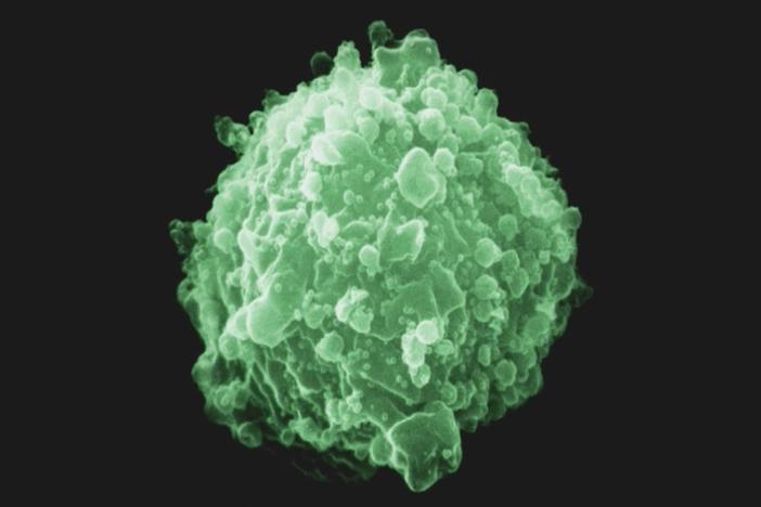 FRONTLINE examines the global spread of an unstoppable virus.