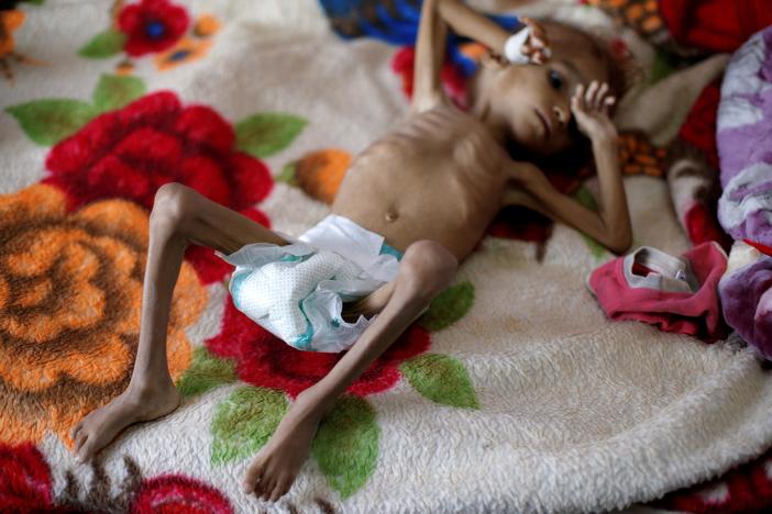 During peace talks, UN envoy says future of Yemen is at risk