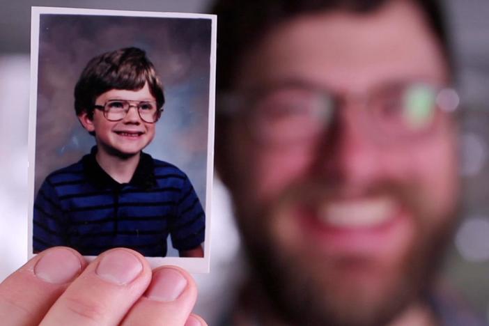 20/Nothing follows Evan Smith, a man who lost his left eye many years ago. 