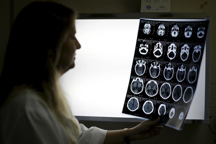 Racial bias in widely used hospital algorithm, study finds