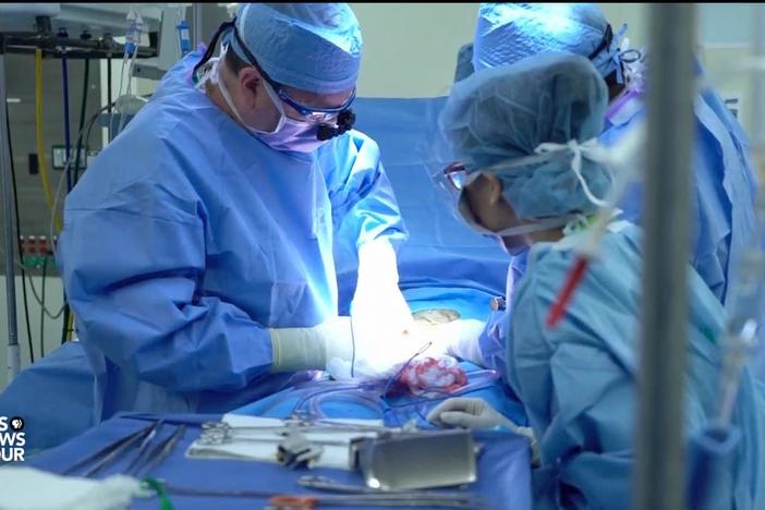 A hundred thousand Americans are on a waiting list for a kidney from a deceased donor.