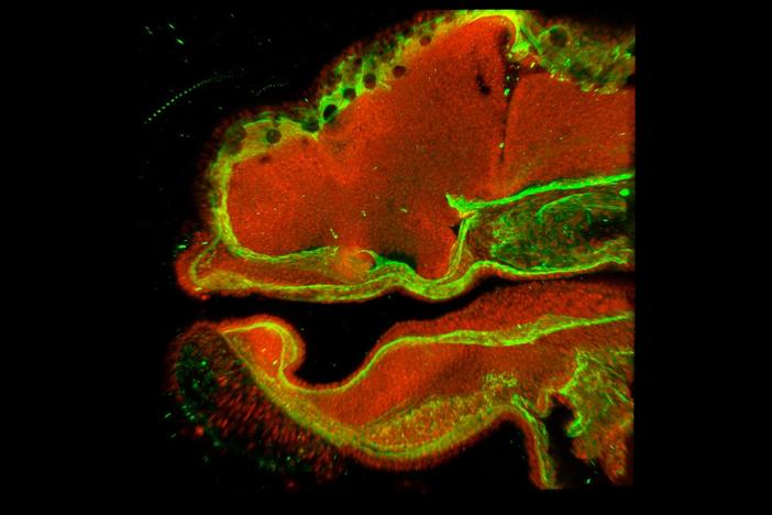 When you were an embryo, a parade of molecules sculpted the cells that became your face.