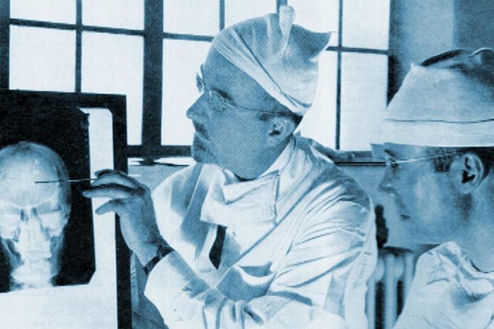 Dr. Walter Freeman gained fame for perfecting the lobotomy.
