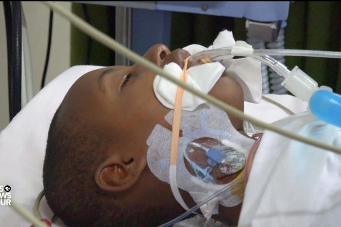 How a volunteer surgical team in Rwanda chooses which patients to save