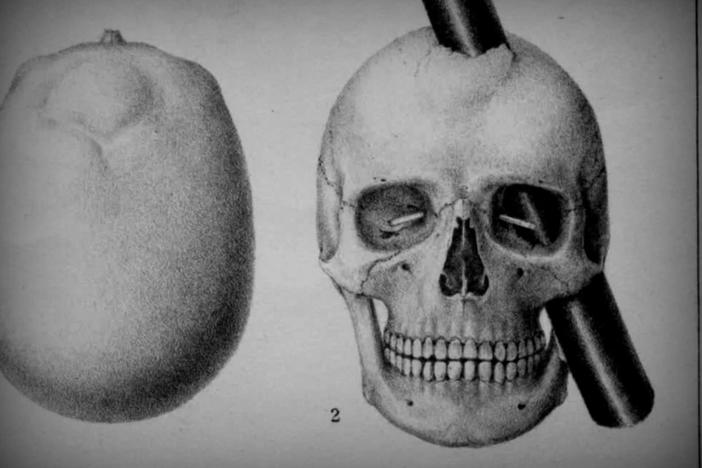 An injury cost Phineas Gage part of his brain, but he lost something else too.