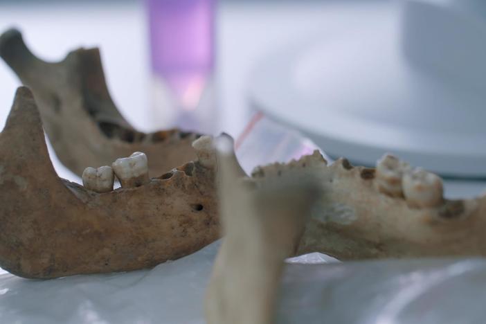 Scientists find signs of plague in tooth samples dating to the Late Roman Empire.