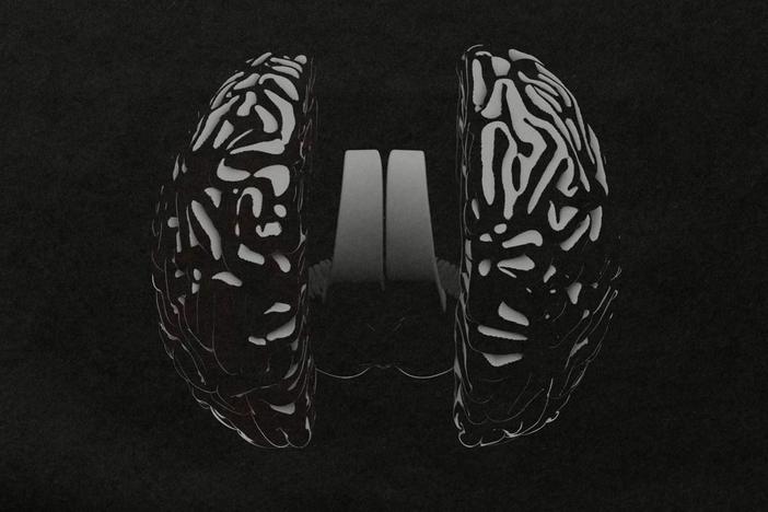 Severing the connection between the two halves of the brain reveals how the hemispheres function.