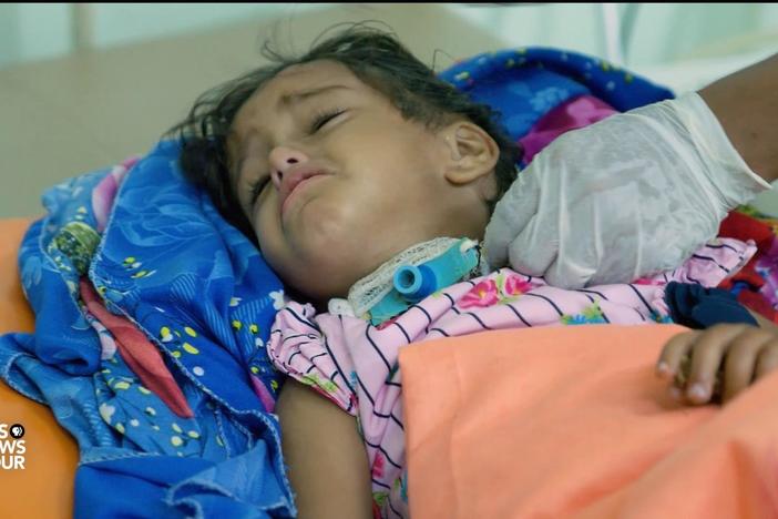 Diphtheria takes a deadly stranglehold on war-torn Yemen