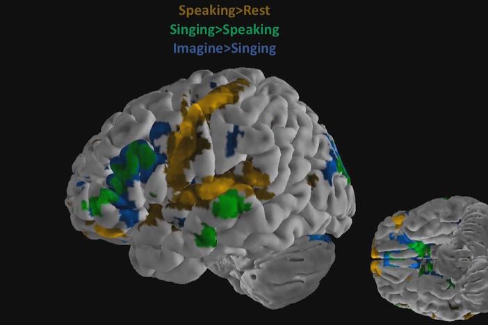 Geneticist and opera singer team up to study how music can improve health