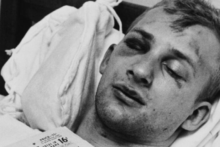 As a white Freedom Rider, Jim Zwerg sustained severe injuries.