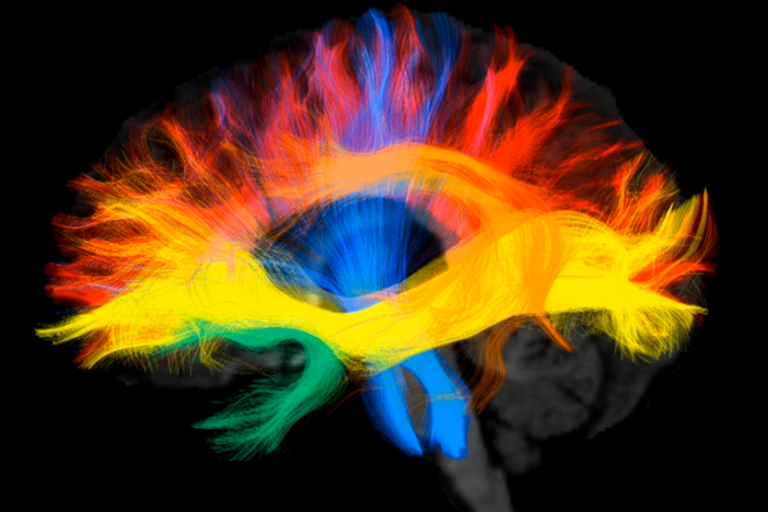 The team building a three dimensional map of the brain’s connections.