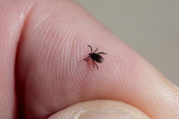 What you need to know to stay safe from ticks and Lyme disease this summer