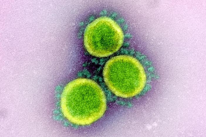 Public health expert says 'zero doubt' most U.S. virus deaths were avoidable