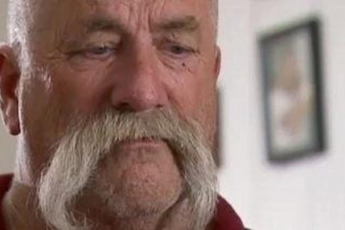 Howard Dully discusses the lobotomy that Walter Freeman performed on him when he was 12.