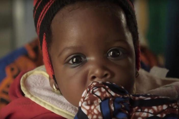 Why Nigeria has more HIV-positive infants than anywhere else