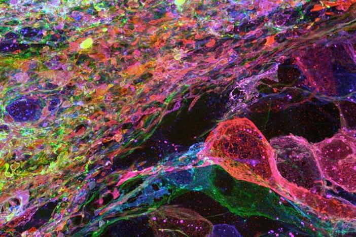 Use just diapers and water to get the closest look at the brain yet.