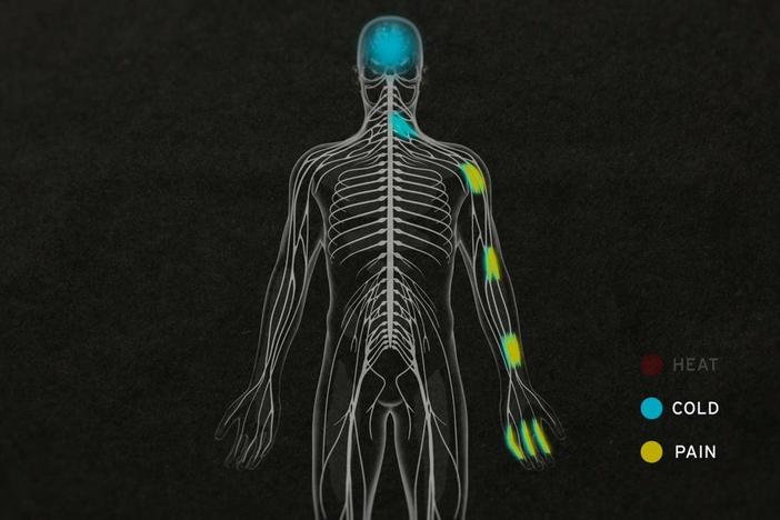 This experiment shows how the brain can interpret — and misinterpret— pain.
