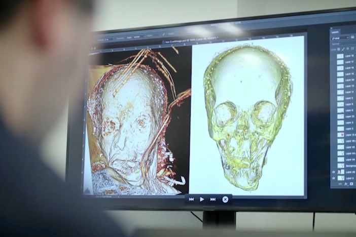 Forensic imaging specialist uses facial reconstruction software to see a face from history