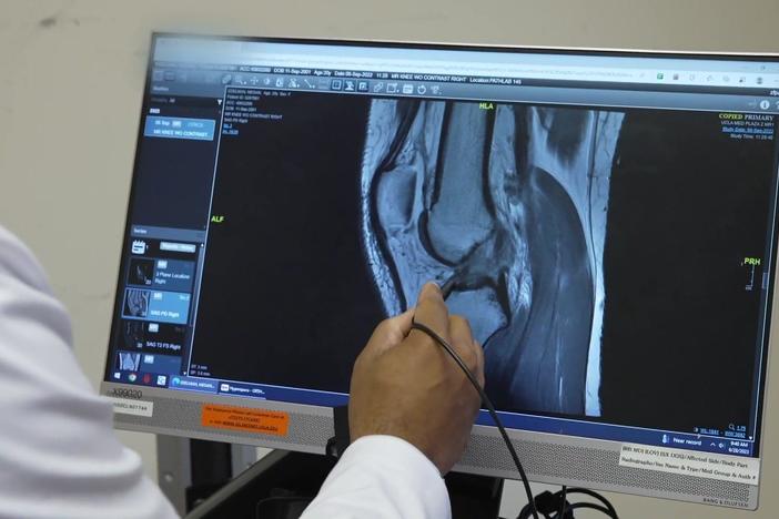Why ACL injuries are more common in female athletes than male counterparts
