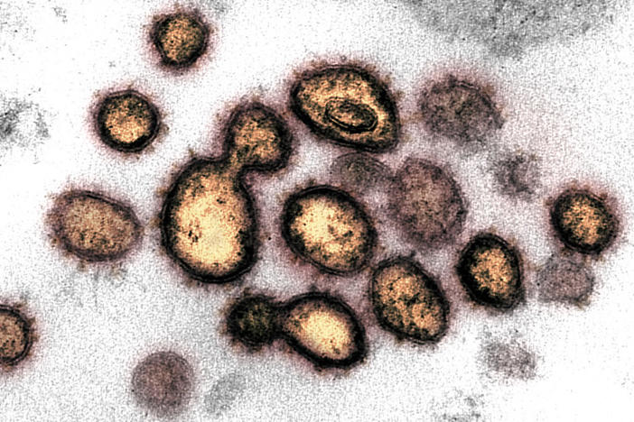 This transmission electron microscope image shows SARS-CoV-2, the virus that causes COVID-19, isolated from a patient in the U.S.
