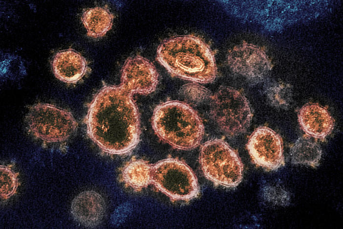 This transmission electron microscope image shows SARS-CoV-2, the virus that causes COVID-19, isolated from a patient in the U.S. The spikes on the outer edge of the virus particles give coronaviruses their name, crown-like.