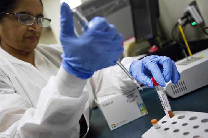 In a Friday, Feb. 9, 2018 file photo, lab technologist Sharda Modi tests a patient's swab for a flu infection at Upson Regional Medical Center in Thomaston, Georgia.