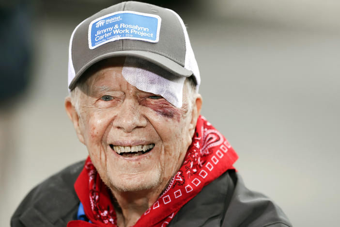 Former President Jimmy Carter answers questions during a news conference at a Habitat for Humanity project Monday, Oct. 7, 2019, in Nashville, Tenn. Carter fell at home on Sunday, requiring over a dozen stitches.