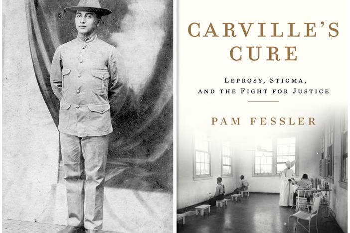 Morris Koll, grandfather of NPR correspondent Pam Fessler's husband, enlisted in the U.S. Army and was sent to the Philippines in 1902. That's when he contracted leprosy. In 1935, public health authorities took him to the national leprosarium in Carville, La. Right: A treatment room at the facility is depicted on the cover of Fessler's new book, <em>Carville's Cure.</em>
