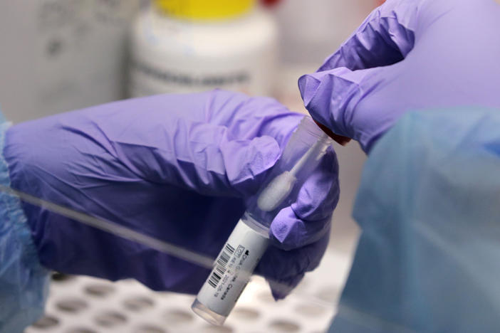 The federal government is giving out funds to develop seven new testing technologies which could increase testing capacity around the U.S.